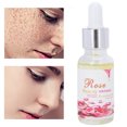 thumbnail image 4 of Aceite Esencial Aceite Facial Equilibrante para el Cuidado Personal Aceite Corporal Hidratante para Hombre Seco Aceite para la Piel para Reducir las Arrugas Aceite de Belleza ANGGREK Otros, 4 of 8