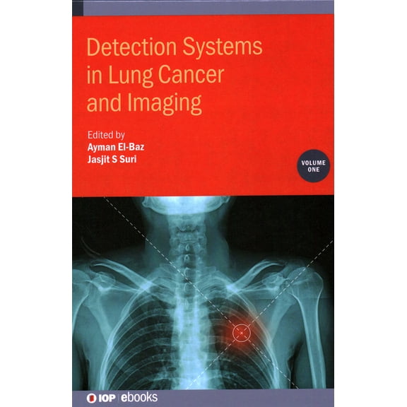 Detection Systems in Lung Cancer and Imaging (Hardcover)