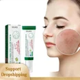 thumbnail image 4 of Suero eliminador de manchas oscuras, crema blanqueadora antienvejecimiento, pigmentación, brillo, Chloasma, 4 of 5
