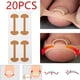 thumbnail image 3 of Pegatinas profesionales para el cuidado de los pies para una corrección sin dolor de las uñas de los pies y una pedicura saludable Solución eficaz para las uñas encarnadas, 3 of 8