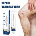 thumbnail image 2 of Herramientas de salud de los pies para la reparación efectiva de venas varicosas y patas de araña, 2 of 5