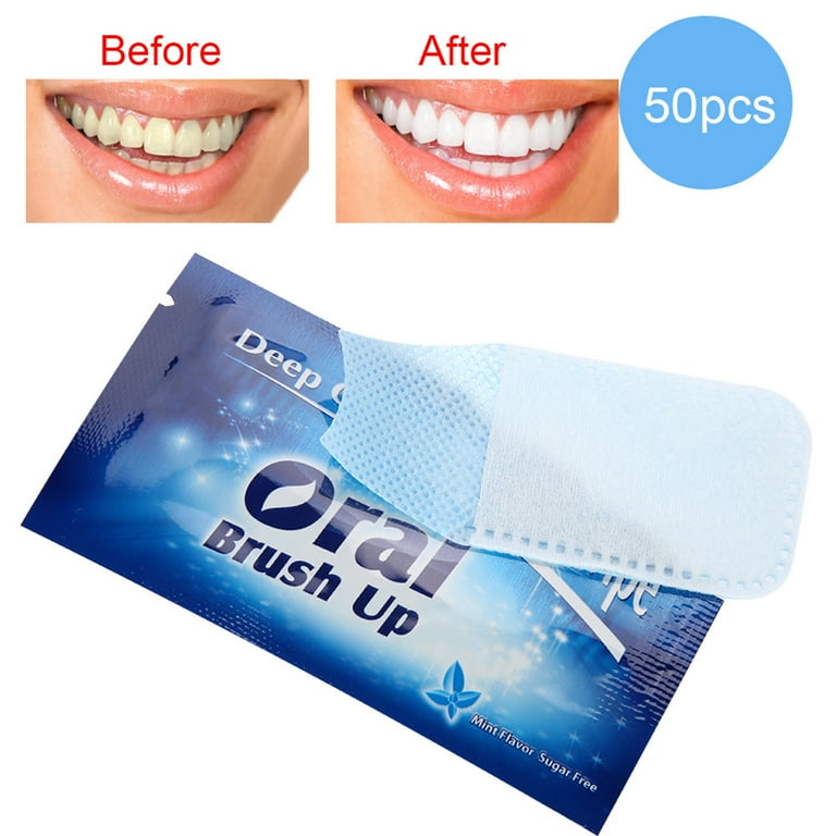 Crest 3D Whitestrips Professional Bright Levels 12 Teeth Whitening Kit, 18  Treatments, 1, 36.0 Count