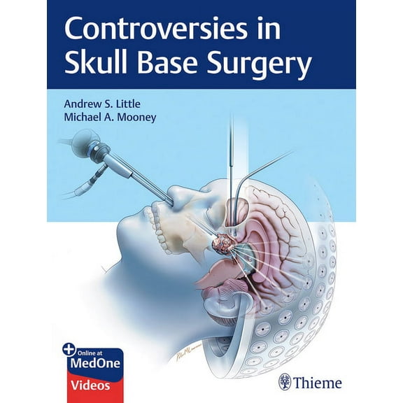 Controversies in Skull Base Surgery (Hardcover)