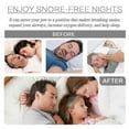 thumbnail image 2 of Embout Buccal Anti-Ronflement, Protection des Dents Molaires pour Dormir la Nuit, 2 of 5
