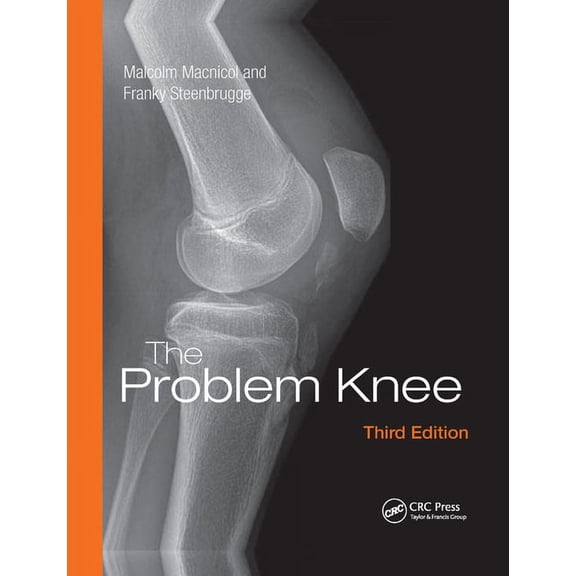 The Problem Knee, (Paperback)