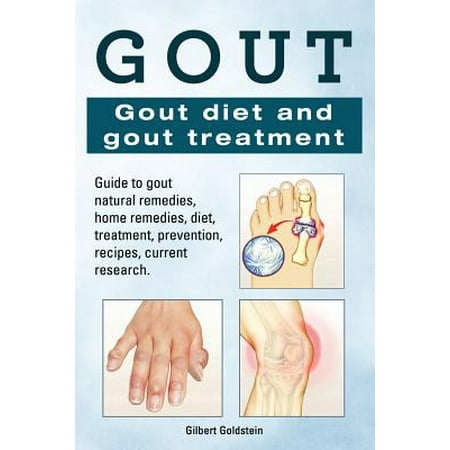Gout. Gout Diet and Gout Treatment. Guide to Gout Natural Remedies, Home Remedies, Diet, Treatment, Prevention, Recipes, Current