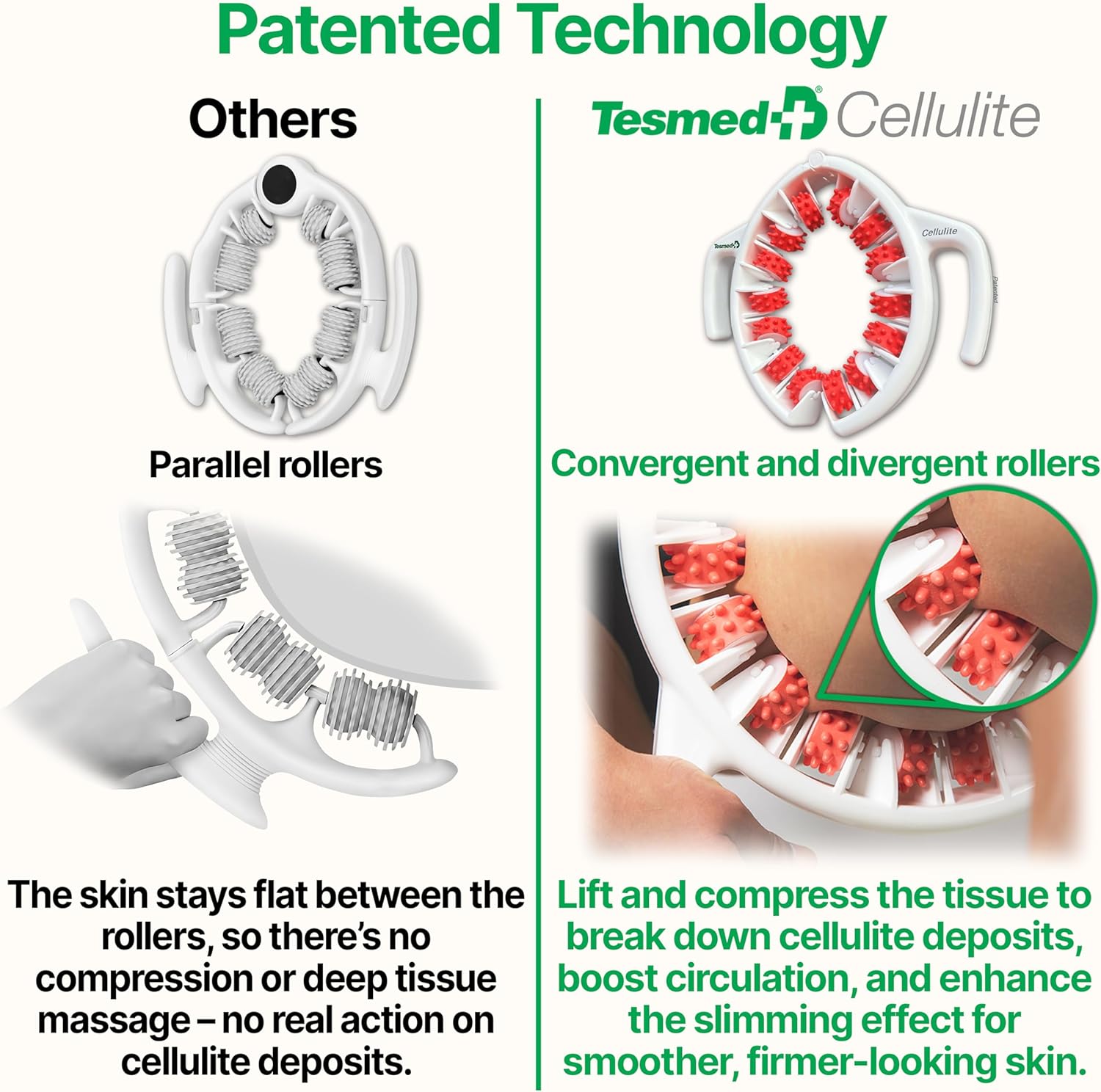 TESMED Cellulite Manual Massager : Made in Italy, Patented with Converging & Diverging Roller Technology. Anti Cellulite Roller for Thighs and Buttock