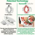 thumbnail image 6 of TESMED Cellulite Manual Massager : Made in Italy, Patented with Converging & Diverging Roller Technology. Anti Cellulite Roller for Thighs and Buttock, 6 of 9