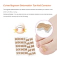 thumbnail image 3 of Corrector de uñas para dedos del pie, pegatinas adhesivas para pulgar encarnado, tratamiento de paroniquia, suministros para ranuras, pedicura, Ayudas para vestirse con gancho de botón Tipo 2 Minnieouse CE012270-02B, 3 of 6