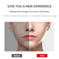 thumbnail image 3 of V-face with LCD Remote Control Sliming Facial Lifting Belt Red Blu-Ray Thin Double Chin and Portable Intelligent Firming Face Slimming Instrument LingWen 9024736131785, 3 of 4