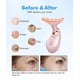 thumbnail image 5 of Masajeador facial y de cuello con terapia de luz roja SDKWDH, color rosa brillante, 5 of 9