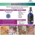 thumbnail image 4 of Allergy Medication For Dog Cat Itchy Skin Relief Dog Skin And Coat Supplement Anti Itch Relief Anti Hot Spot Paw Cleaner Soother Treatment Best Dog Moisturizer For Dry Skin Pet Wound Care Spray (4oz), 4 of 5