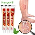 thumbnail image 2 of Pomada antiinflamatoria para tratamiento de Psoriasis, crema para Dermatitis, prurito, Peeling, rojeces, infección por hongos, Eczema, 1-2-4pc, 2 of 4