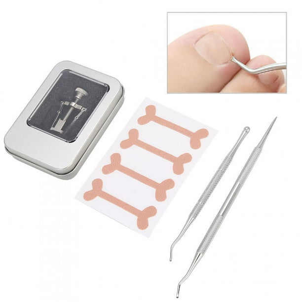 Parche Corrector De Uñas Encarnadas, Corrector De Uñas Encarnadas, Kit De Lima De Uñas Empujador De Cutículas