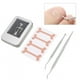 thumbnail image 1 of Parche Corrector De Uñas Encarnadas, Corrector De Uñas Encarnadas, Kit De Lima De Uñas Empujador De Cutículas, 1 of 7