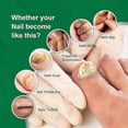 thumbnail image 5 of Nail Repair Essence Fungus Treatment Anti Fungal Infection For Toe Nail Nail, 5 of 5