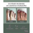 thumbnail image 4 of 5x Healthroutine Nail Care Pen Cosmetic Nail Fungus Treatment Quick Intensive For Nails With Aloe Vera Tea Tree Oil_c5_y146, 4 of 5
