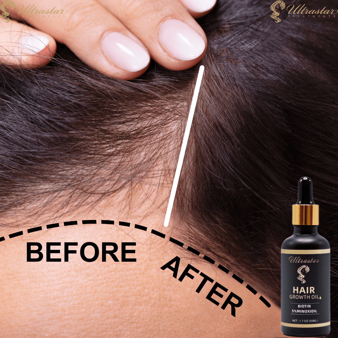 Time to Grow-Hair Growth Serum - Walmart.com
