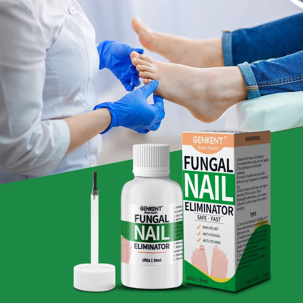 Genkent Nail Fungus Treatment, Toenail Fungus Treatment, Fungus Stop