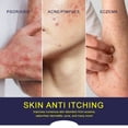 thumbnail image 4 of Crema Para La Picazón De La Piel, Ungüento Para Aliviar La Picazón De Fácil Aplicación Para Uso Doméstico Para La Dermatitis Seborreica, 4 of 7