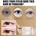 thumbnail image 3 of Double Eyelid Styling, Eyelet Lace Mesh Invisible Glue-Free Breathable Super Stick Long Lasting Clip Set, 3 of 5