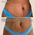 thumbnail image 4 of Cicatrissim White Stretch Mark Cream, Intensive Body Moisturizer for Uneven Skin Texture, All Skin Types, 5.3 oz, 4 of 8