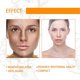 thumbnail image 4 of 1pc Suero de cúrcuma Eliminador de manchas oscuras, Corrector de manchas oscuras Suero facial para rostro y cuerpo, 4 of 5