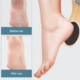 thumbnail image 3 of Removedor de callos para lima de pies: kit de pedicura multiusos 4 en 1 para pies con cepillo de cerdas para el cuidado de los pies, piedra pómez, raspa para pies y papel de lijaBambú, 3 of 7