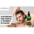 thumbnail image 4 of Set de 10 Botellas de Bálsamo Auxiliar en Tratamiento de Calvicie Josue Echavarria Natural, 4 of 6