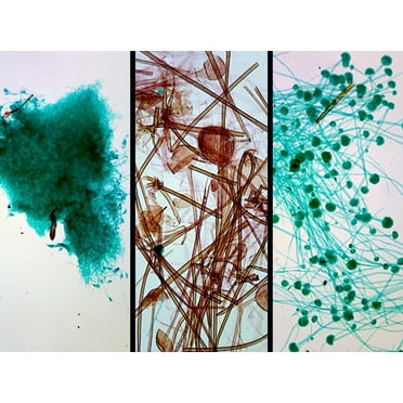 Prepared Microscope Slide showing Three Types of Mold, Aspergillus, Penicillium, and Rhizopus, Whole-mount