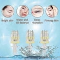 thumbnail image 3 of 20PCS Mesotherapy Crystal Multi Needle 5 Pin 32G 1.5MM Crystal Multi Needle 5Pins 4Pns 3Pins 32g 34g 1.0mm 1.25mm 1.5mm Mesotherapy M, 3 of 5