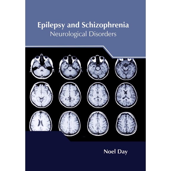 Epilepsy and Schizophrenia: Neurological Disorders, (Hardcover)