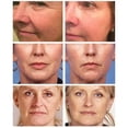 thumbnail image 2 of Crema facial eliminadora de arrugas instantánea, Lifting, reafirmante, desvanecimiento de líneas finas, blanqueamiento antienvejecimiento, hidratante, iluminador, Cosméticos Coreanos, 2 of 3
