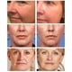 thumbnail image 2 of Crema facial eliminadora de arrugas instantánea, Lifting, reafirmante, desvanecimiento de líneas finas, blanqueamiento antienvejecimiento, hidratante, iluminador, Cosméticos Coreanos, 2 of 3