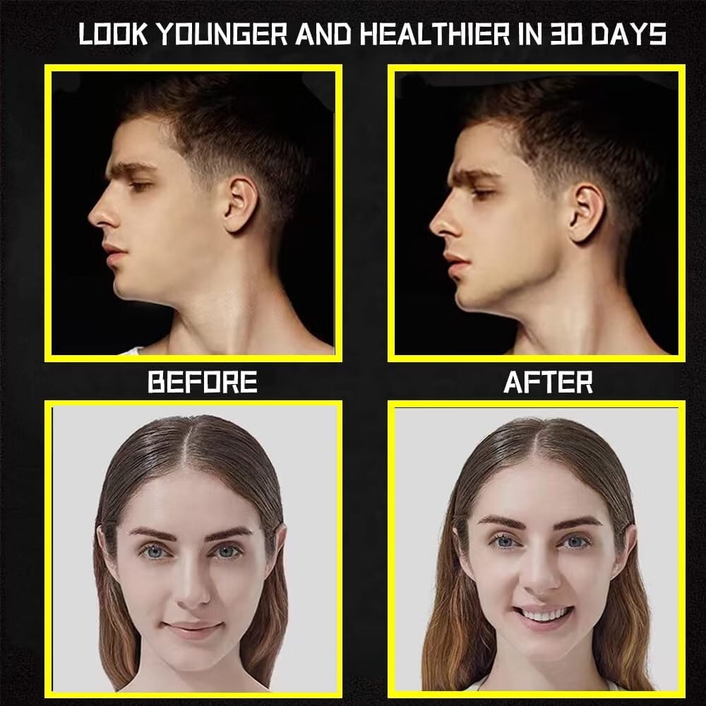 MSHUN Jaw Exerciser Jawline Exerciser Double Chin Eliminator Double Chin Reducer Men Women Jawline Gum Face Slimmer BPA Free Silicone Exercise Equipment Workout Kit Black Gray 4PCS Walmart