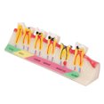 thumbnail image 4 of Modelo de desarrollo de caries dental, modelo portátil de dientes cariados para estudio de enseñanza dental, 4 of 8