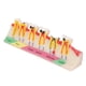 thumbnail image 3 of Modelo de desarrollo de caries dental. Modelo portátil de dientes cariados para estudio de enseñanza dental., 3 of 14