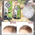 thumbnail image 2 of Ginger Plant Extract Anti-Hair Loss Hair Shampoo, 2 of 5