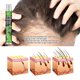thumbnail image 3 of Herramienta para el cabello denso con esencia natural espesante para la prevención de la caída del cabello (simple) Likrtyny Cuidado Belleza, 3 of 6