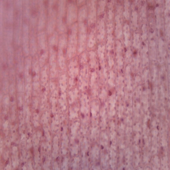 10PK Chloroplasts - Prepared Microscope Slides - Classroom Pack, 10 Slides in Storage Case - Biology & Microscopy - Eisco Labs