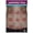 Framed, variant on Causes of Abdominal Pain Poster (5) Canvas Painting for Living Room Bedroom Decor