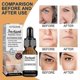 thumbnail image 2 of Jaysuing Face Serum Wrinkles Remover Anti-aging Fade Fine Lines Serum Whiten, 2 of 5
