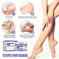 thumbnail image 1 of CYC Varicose Veins Veins Improve Blood Circulation Varicose Vein For Legs And Of Legs Fast (30g), 1 of 5