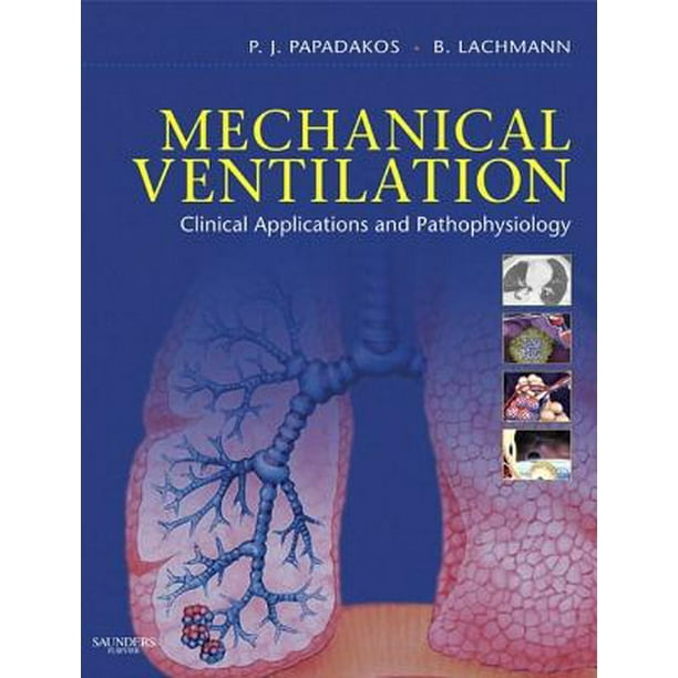 Mechanical Ventilation EBook eBook
