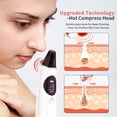 thumbnail image 3 of Blackhead Remover Vacuum Electric Blackhead Remover Kit Pore Vacuum Blackhead Remover Acné Aspirador con 4 sondas funcionales Limpiador de piel Adepaton 2035601, 3 of 9