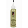 thumbnail image 1 of Doo Gro Huile Anti-Démangeaisons 4,5 fl oz, 1 of 4