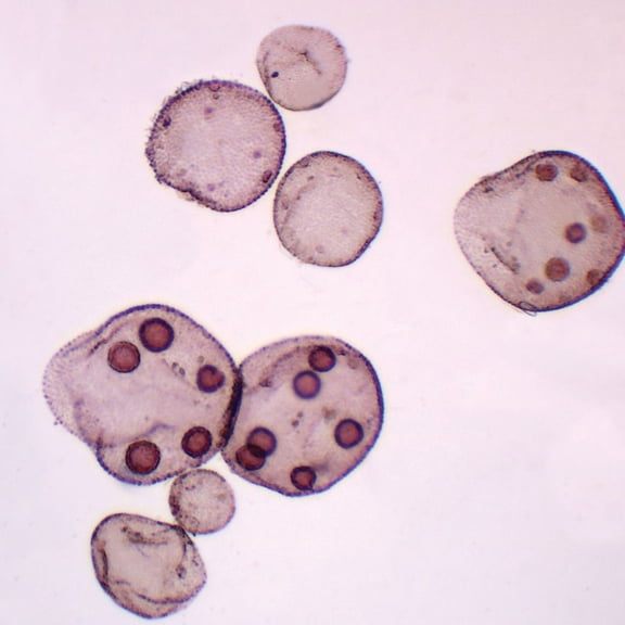 Volvox Asexual Stages Slide, W.M.