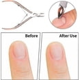 thumbnail image 3 of 3 piezas Coupe-cuticules Avec Poussoir Envies, o Rose, Pour Repousser Cuticule En Acier Inoxydable Ciseaux Ongles Professionnel Outils Manucure, 3 of 5