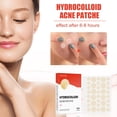 thumbnail image 5 of 144 parches para el acné, para uso diurno y nocturno, 2 en 1, invisibles, efectivos, hidrocoloides que absorben las espinillas del acné, pegatinas impermeables para el acné en la cara, 5 of 5