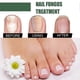 thumbnail image 3 of 50ml Nail Fungus Treatment Solution Extracts Remove Onychomycosis No Yellowing Restore Shine Nail Repair Care, 3 of 5